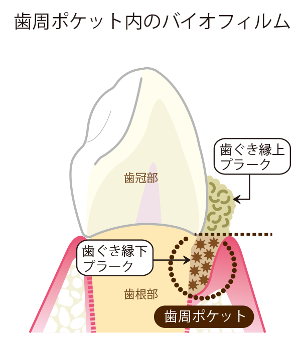 biofilm