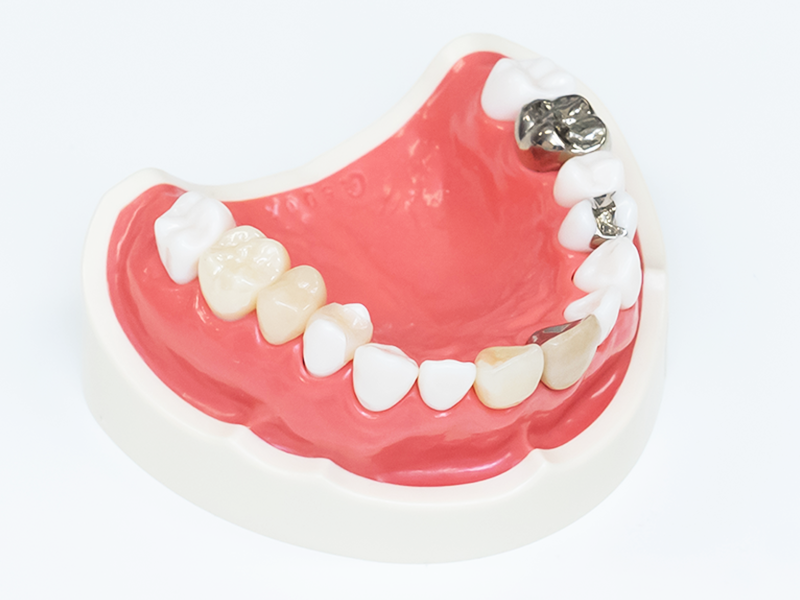 セラミック　見本