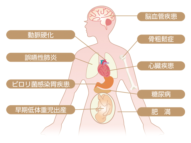 歯周病疾患